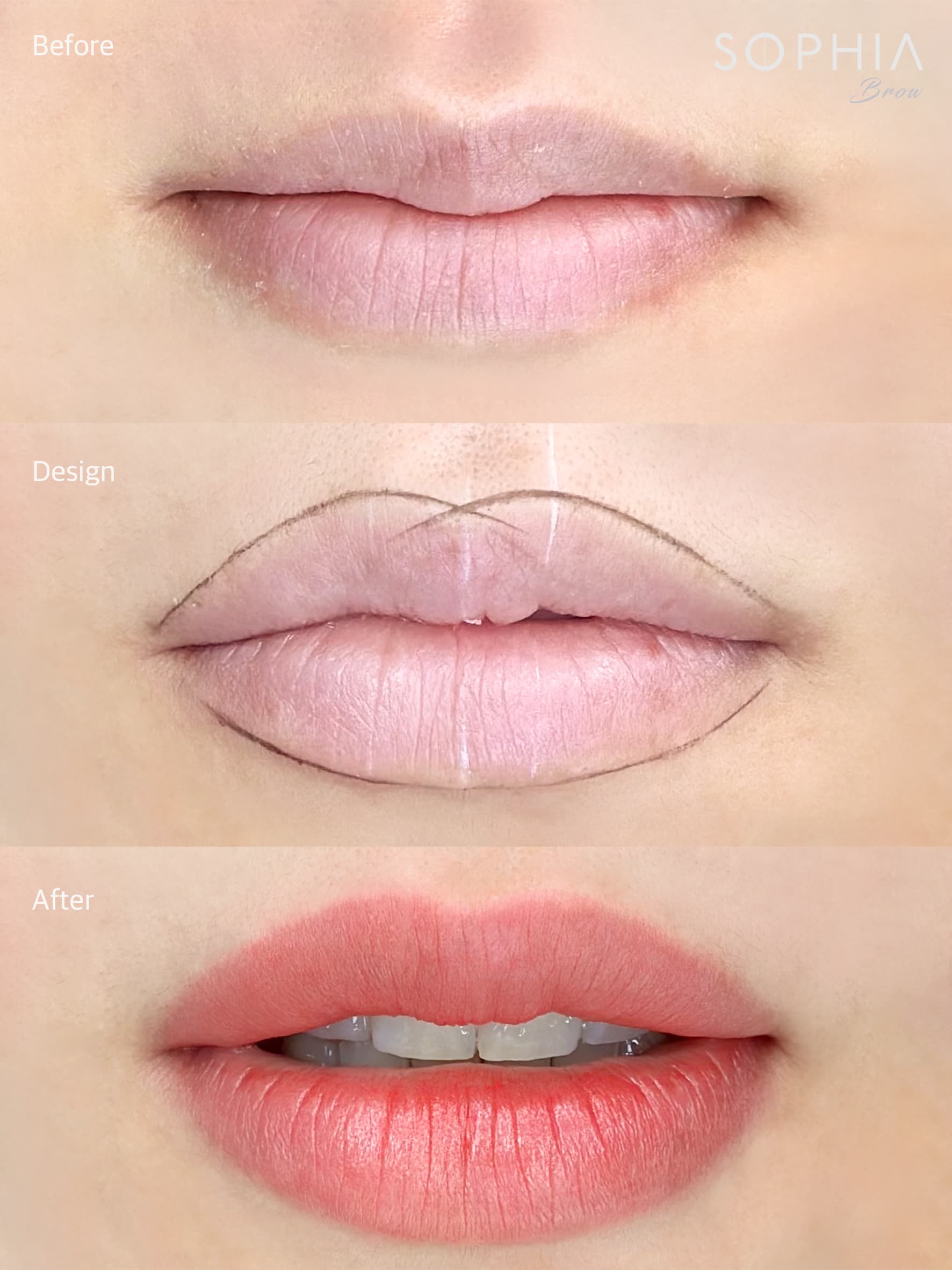 칙칙했던 입술이