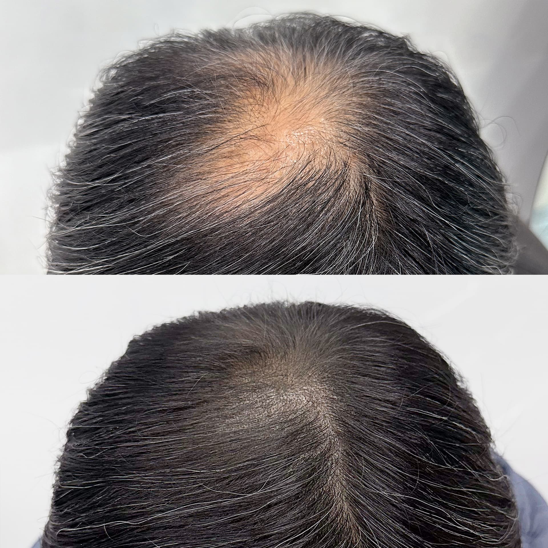 가까이 봐도 티 나지 않는