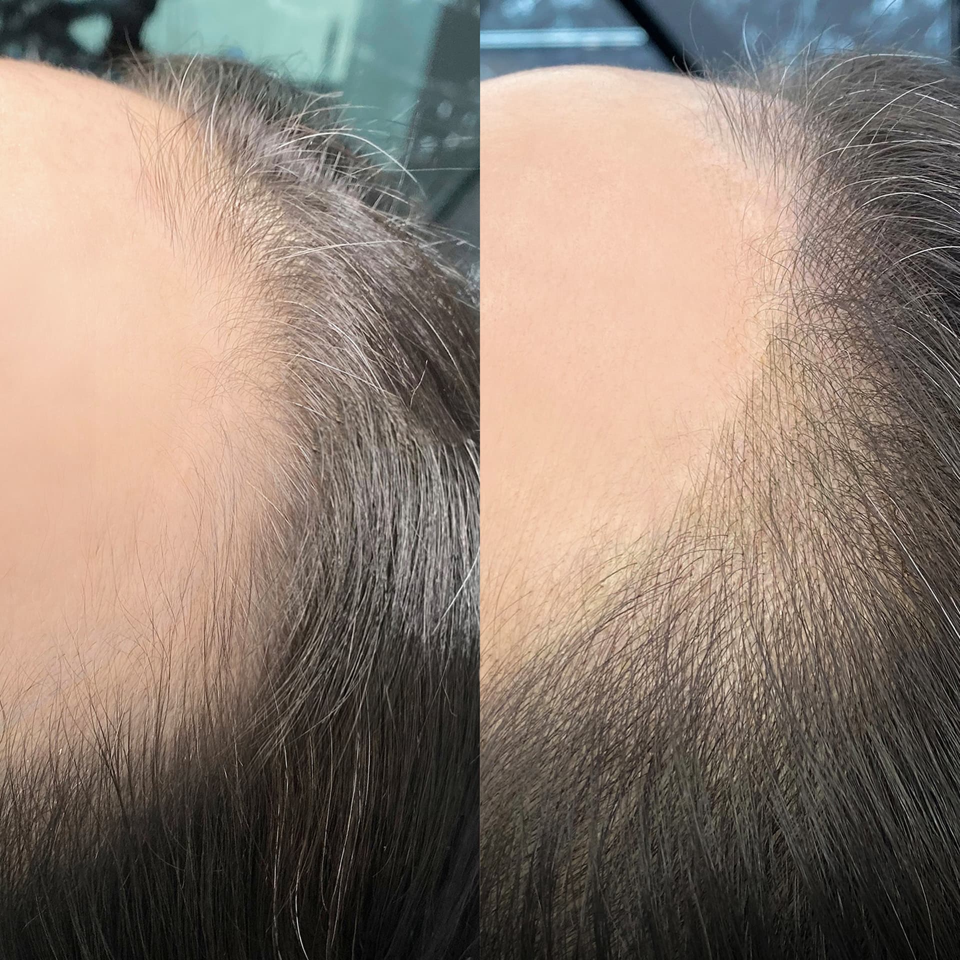 정돈된 헤어라인 하나로